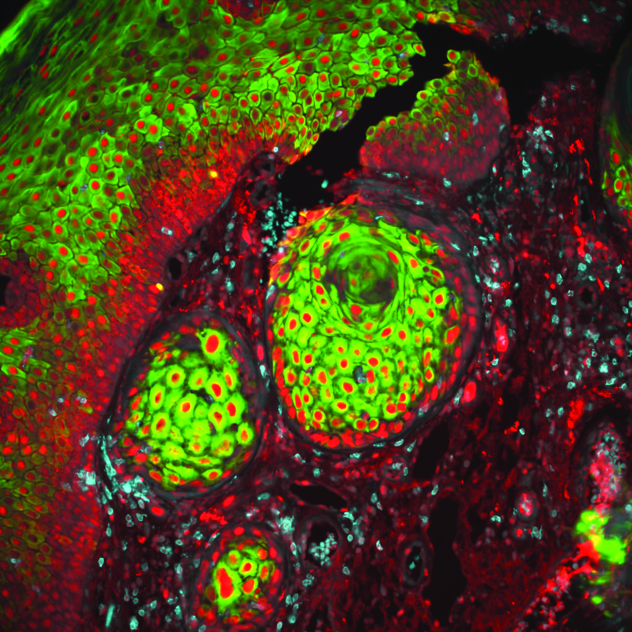 Green, red, and black image of a cell
