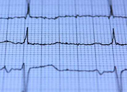 An image of an electrocardiogram